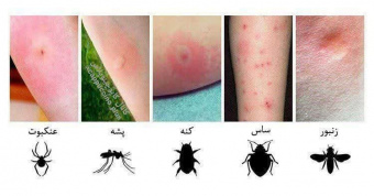 پوستر آموزشی تشخیص عامل گزش براساس مشاهده و معاینه پوست بیمار و اثر باقی مانده بر روی آن