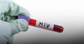 ایدز؛ نیازمند اطلاع رسانی، پیشگیری و نگاه علمی است